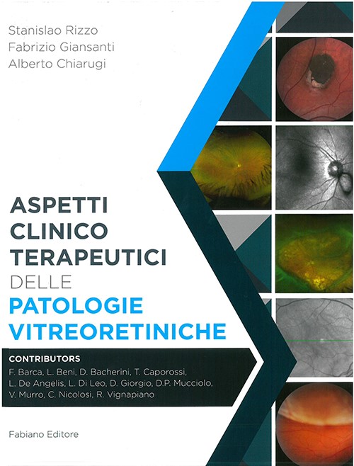 vitreoretiniche
