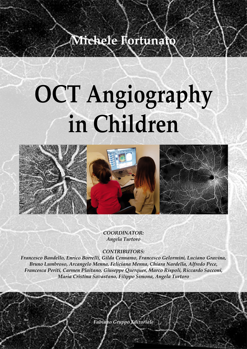 OCT_angiography_Fortunato