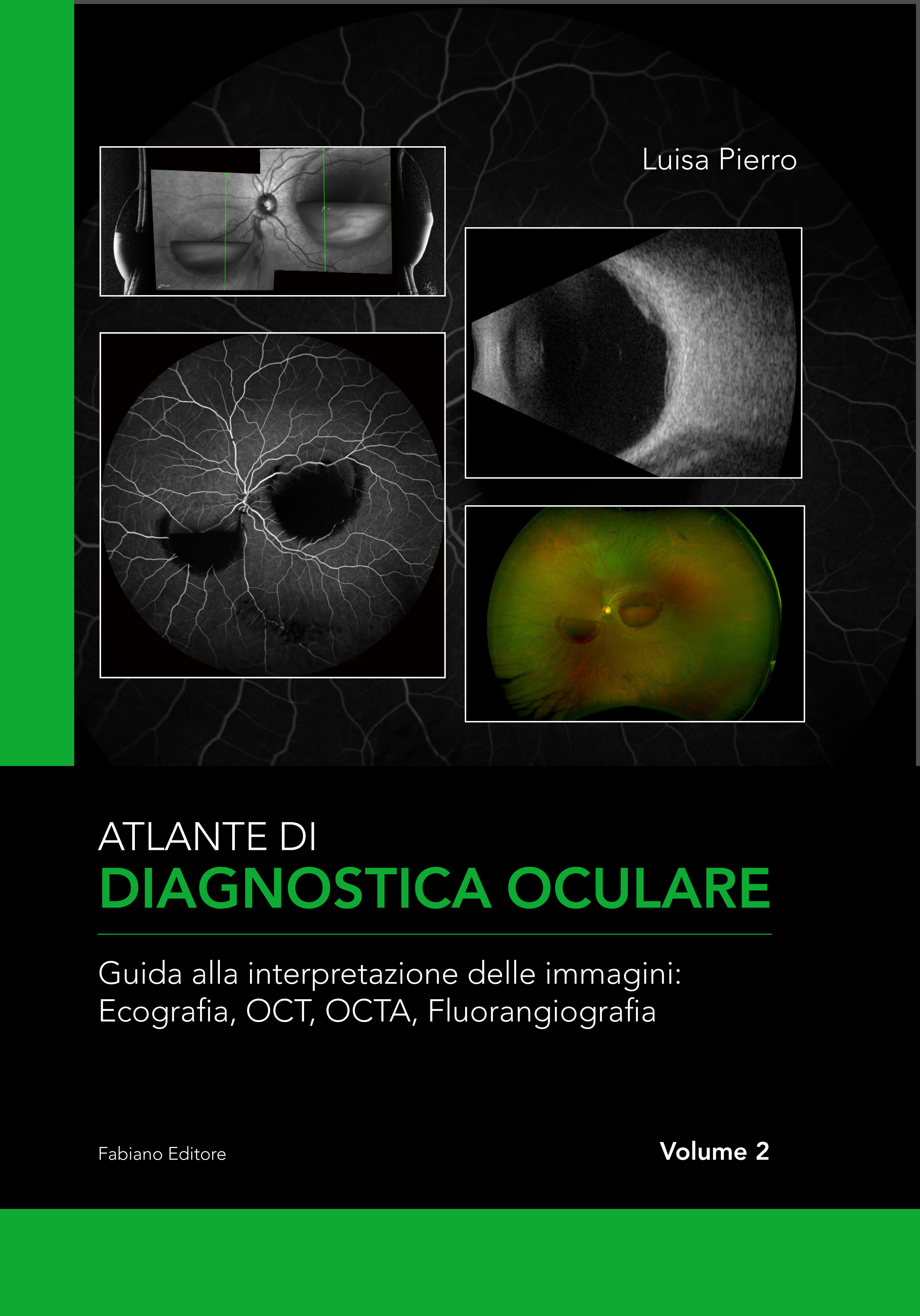 atlante_pierrovol2